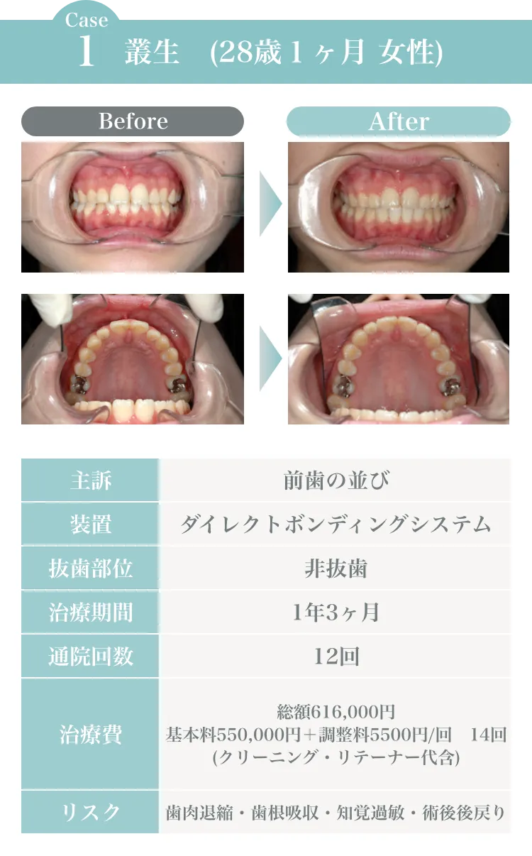 サンプル画像