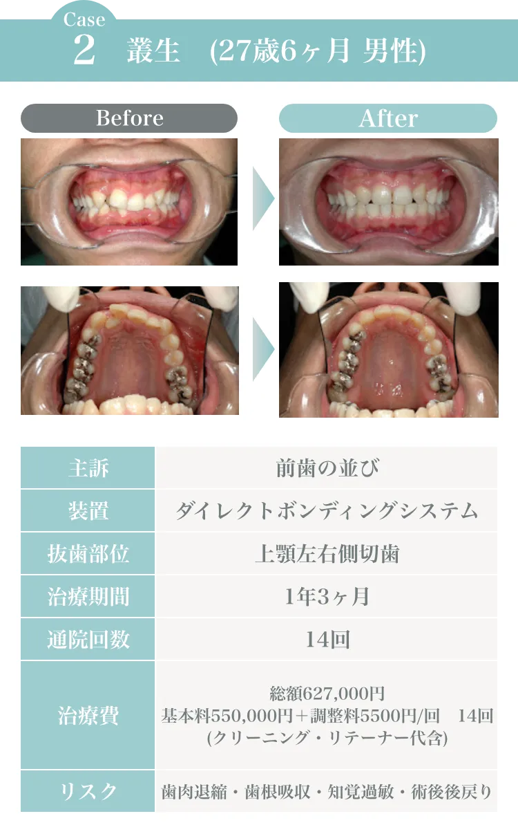 サンプル画像