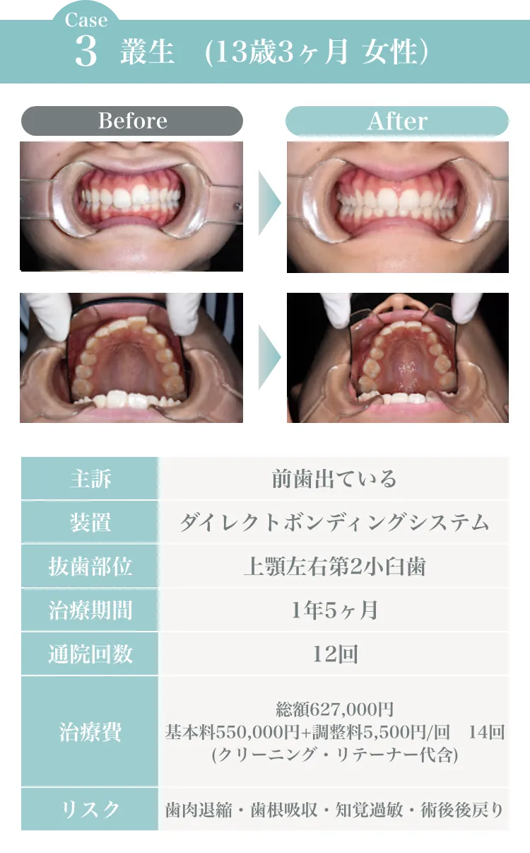サンプル画像